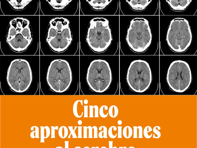 Cinco aproximaciones al cerebro